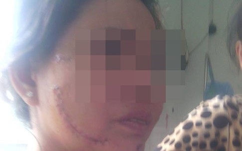 Chân dung hai mặt của gã đàn ông ngày ngon ngọt xin tiền, đêm vác dao “dạy vợ”