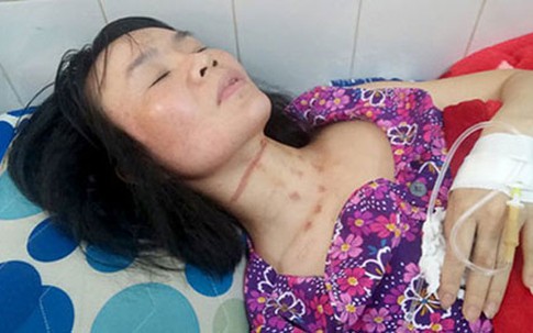 Vụ chủ quán cafe bị bóp cổ: Lộ mặt gã em nuôi