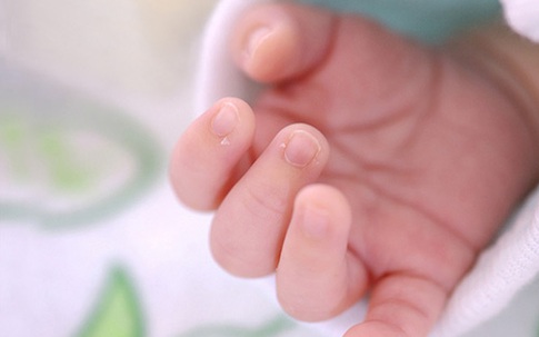 Nhìn tay đoán tín hiệu sức khoẻ của trẻ sơ sinh