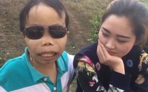 Tìm hiểu về căn bệnh “đại gia xấu trai nhất Trung Quốc" mắc phải