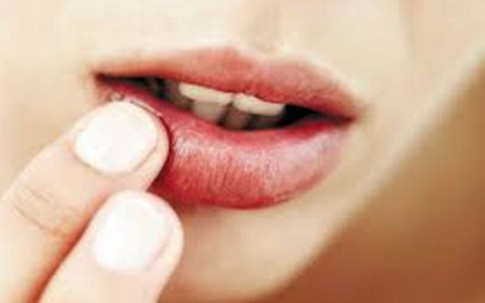 Đẩy lùi nhiệt miệng