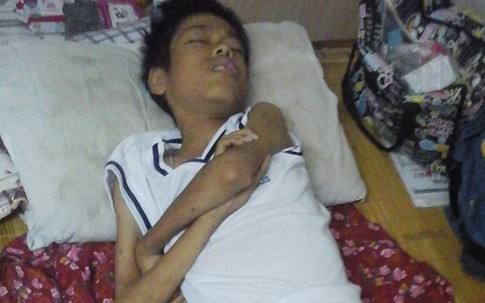 Cậu bé 15 năm giành giật… sự sống