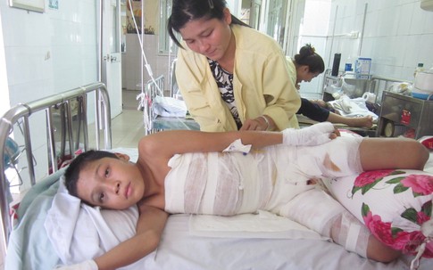 Gia cảnh đáng thương của cậu bé bị bỏng nặng phải cắt bỏ bộ phận sinh dục