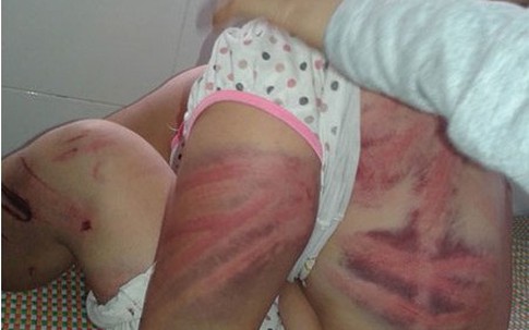 Phẫn nộ những phụ nữ hút chết dưới tay chồng tàn bạo