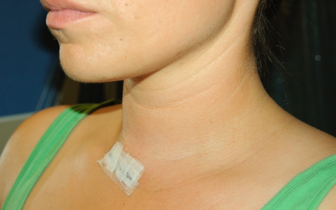 Hỏi và đáp về bệnh lý tuyến giáp
