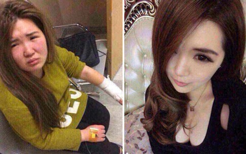 Hành hung bạn gái quen qua mạng vì mặt thật quá xấu