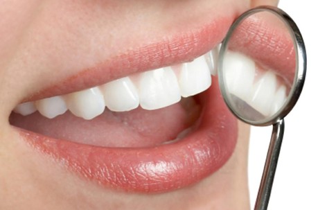 Cấy ghép Implant – Giải pháp trồng răng bị mất
