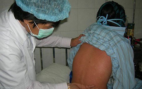 Xuất hiện ổ dịch rubella tại Bình Dương: 138 ca nghi nhiễm