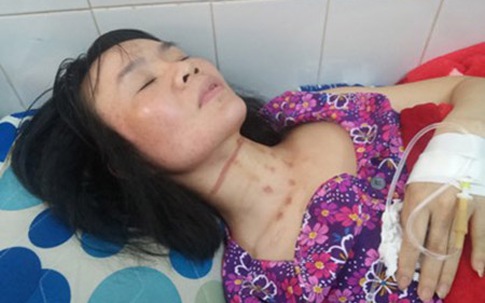 Lời kể kinh hoàng của chủ quán cà phê bị kẻ cướp cố sát