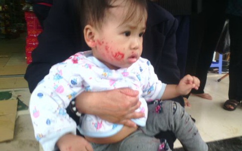 Xe khách đấu đầu xe tải, nhiều người thương vong