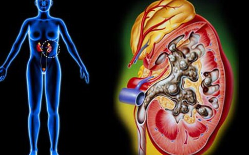 8 nguyên tắc vàng giúp bảo vệ thận