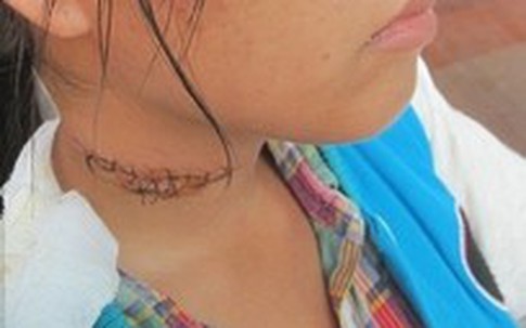 Cứa cổ vợ vì nói chuyện với đàn ông lạ