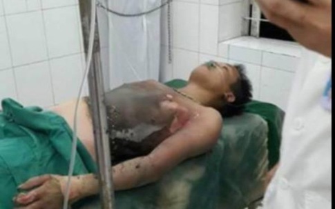 Giận vợ, nam thanh niên tẩm xăng tự tử