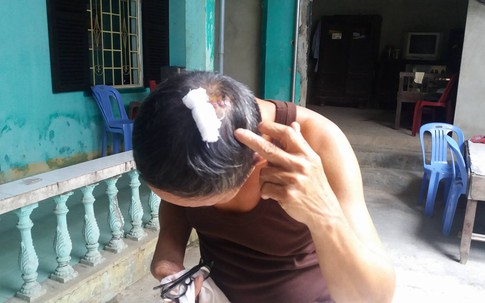Cha con chi hội trưởng người mù bị đánh dã man tại nhà