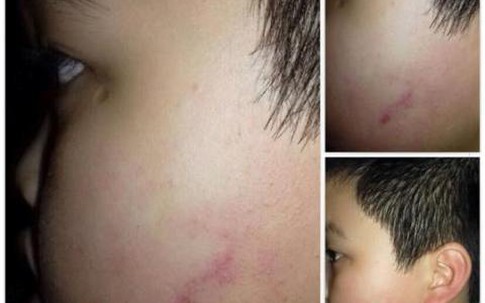 Đình chỉ cô giáo cho 42 học sinh tát bạn cùng lớp