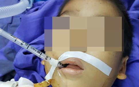 Vụ thảm án gia đình tại Tuyên Quang: Bác sĩ hiến máu cứu cháu bé