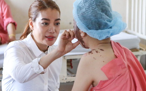 Trương Ngọc Ánh hỗ trợ sửa lại gương mặt cho nữ sinh bị tạt axit