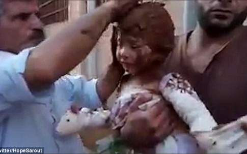 Xót xa cảnh bé gái Syria phải chữa bỏng bằng bùn ướt sau khi trúng bom napalm