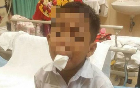 Cậu bé 7 tuổi tự cắt lưỡi vì bị bạn bè bắt nạt