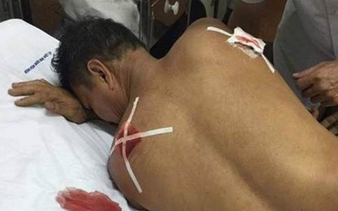 Bị ném đá thủng mái nhà, sang hỏi hàng xóm thì suýt mất mạng