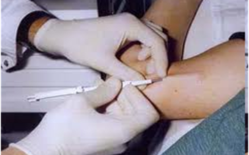 Lý giải việc “cấy que tránh thai mà vẫn dính bầu” ở Đà Nẵng