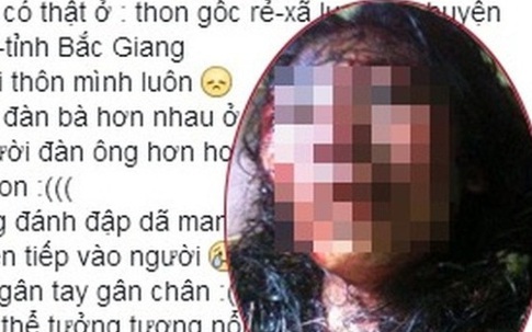 Chồng vũ phu chém vợ đứt gân