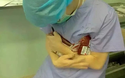 Bác sĩ dùng hơi ấm cơ thể để làm nóng túi máu