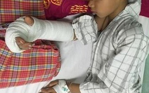 Nối bàn tay bị đứt gần lìa cho bé trai 8 tuổi