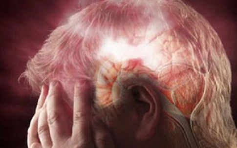 Máu lên não kém có thể gây đột quỵ nguy hiểm