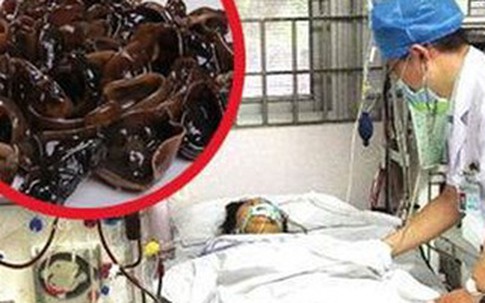 Đừng bao giờ chế biến mộc nhĩ như người phụ nữ này kẻo vong mạng