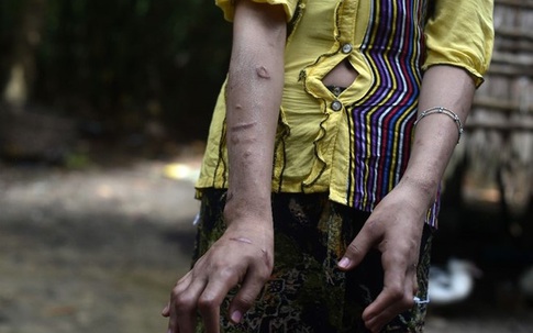 Tháng ngày 'bị cứa, bị đốt' của nô lệ trẻ em ở Myanmar