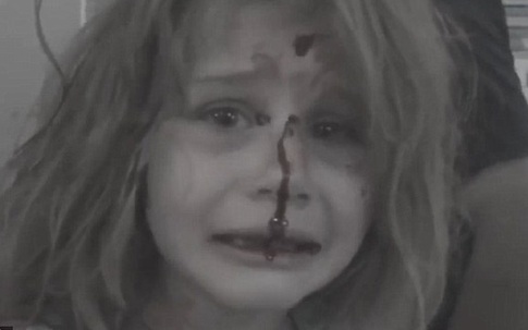Bé gái Syria kêu khóc gọi cha với khuôn mặt đầy máu sau vụ nổ bom