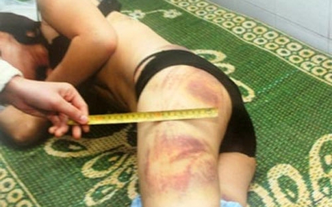 Nỗi đau dấu kín của nhiều phụ nữ khi phải cắn răng "chiều chồng"