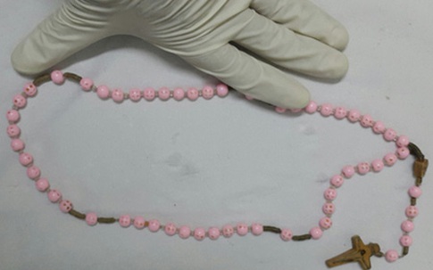 Chuỗi hạt dài 80 cm trong thực quản cụ bà 73 tuổi
