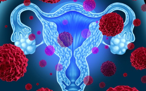 Những con đường lây nhiễm virus HPV gây ung thư cổ tử cung