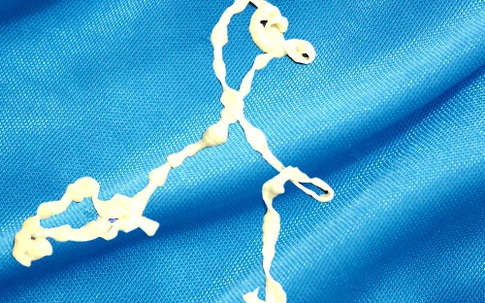 Sán xơ mít dài hơn một mét trong bụng người đàn ông