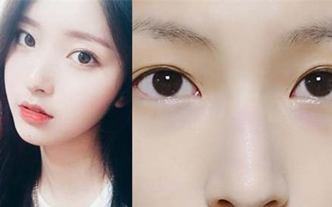 Rửa mặt bằng nước cải bắp luộc giúp da mặt trắng bóc, lỗ chân lông se khít