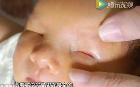Siêu âm thai nhi bình thường, mẹ bỗng bàng hoàng khi con sinh ra không có mắt