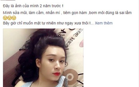 Cô gái nghiện phẫu thuật thẩm mỹ chia sẻ những biến chứng và tác hại mà mình phải chịu đựng