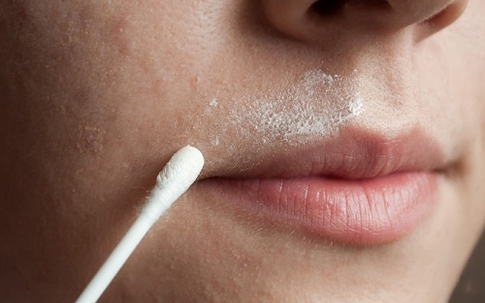 Bất ngờ với 9 công dụng làm đẹp “rẻ như bèo” từ oxy già ít người biết