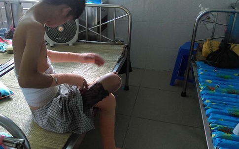 Nỗi sợ của đứa trẻ sống sót sau vụ cháy làm 8 người chết ở Hà Nội