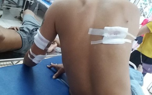 Thanh Hóa: 3 thanh niên bị nhóm người bịt mặt bắn trọng thương