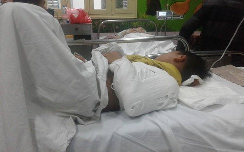 Vụ sập lan can trường học làm 13 học sinh bị thương: Thêm 1 nạn nhân phải phẫu thuật não