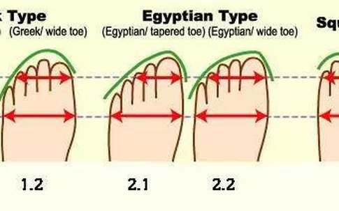 Nguyên nhân chẳng ngờ tới khiến bạn bị đau chân khi đi giày cao gót