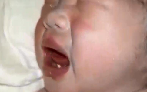 Trẻ vừa mới sinh đã mọc răng có đáng lo?