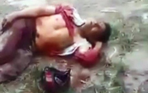 Tài xế xe ôm bị khách đâm trọng thương để cướp tài sản