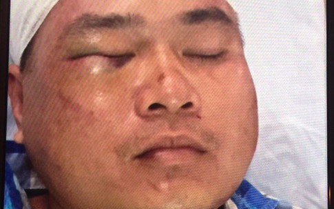 Hải Phòng: Điều tra làm rõ nhóm côn đồ truy sát người dân