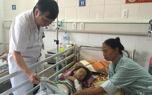 Con suýt gặp họa vì cha mẹ đắp lá chữa bỏng