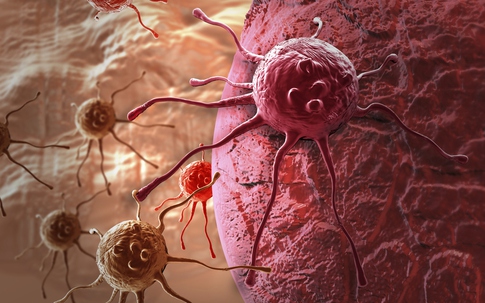 Tỷ lệ mắc ung thư của Việt Nam thuộc nhóm trung bình thấp