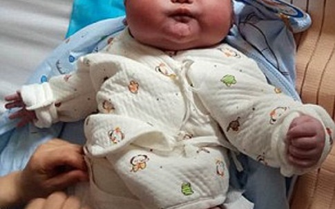 Được bác sĩ thông báo trước nhưng bố mẹ vẫn không thể ngờ con sinh ra thế này